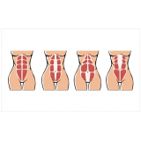 clínica especializada em tratamento diástase abdominal Vila Alexandria