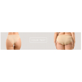 gluteoplastia com bioestimulador Vila Lúcia