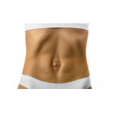 tratamento da diástase abdominal Jardim Novo Carrão